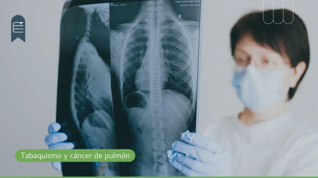 Tabaquismo y cáncer de pulmón: impacto en la salud respiratoria y cesación tabáquica